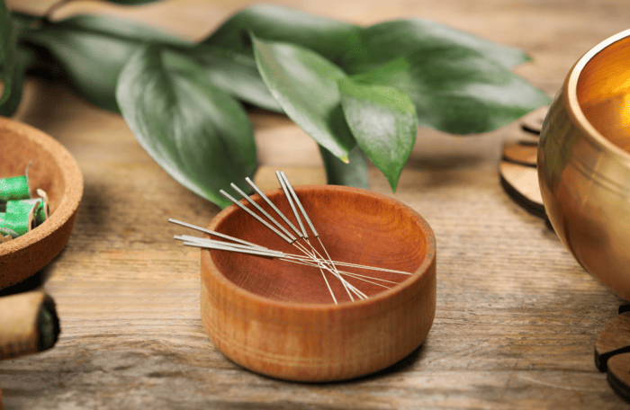 image de l'article L'acupuncture : une aide naturelle à la fertilité