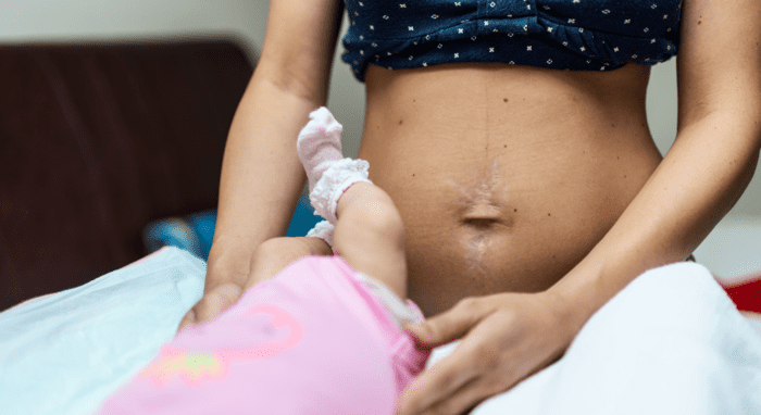 image de l'article La dégestation : comprendre cette étape souvent méconnue