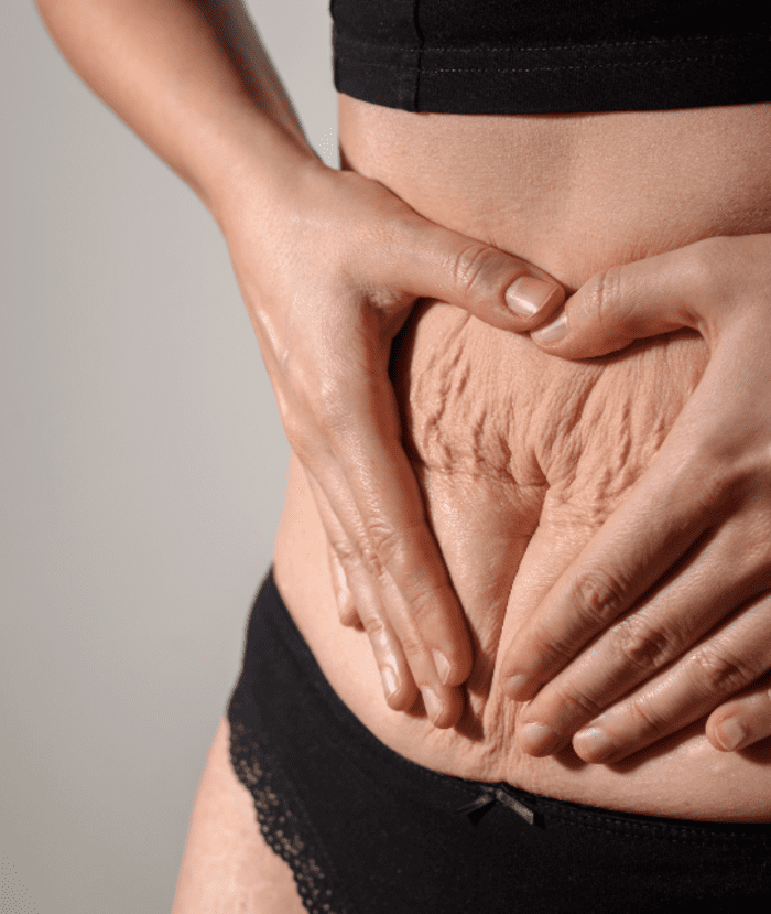 image de l'article Prendre soin de son ventre après l'accouchement : aspects physiques et émotionnels