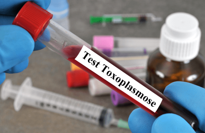 image de l'article Toxoplasmose chez la femme enceinte : symptômes, dépistages et traitement
